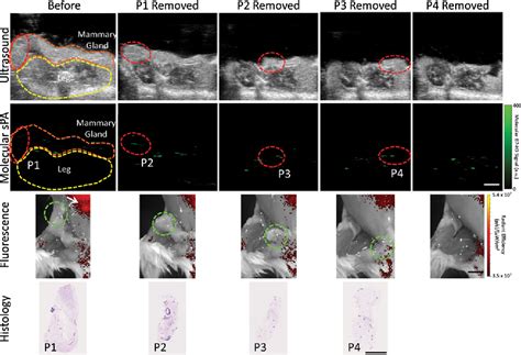 Figure From Intraoperative Resection Guidance With Photoacoustic And