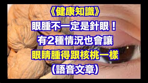 《健康知識》眼腫不一定是針眼！ 有2種情況也會讓眼睛腫得跟核桃一樣（語音文章） Youtube