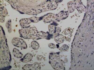 Common Gamma Chain Il R Gamma Antibody Mm A Azide And Bsa