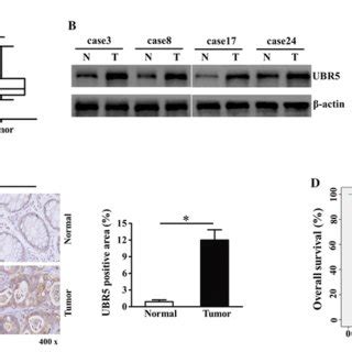 Relative Ubr Expression In Crc Tissues And Its Clinical Significance