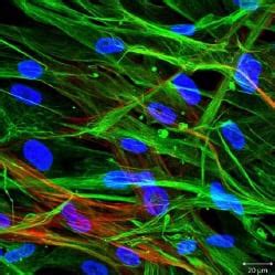 Fibroblast Cell Markers | Research Areas: Novus Biologicals