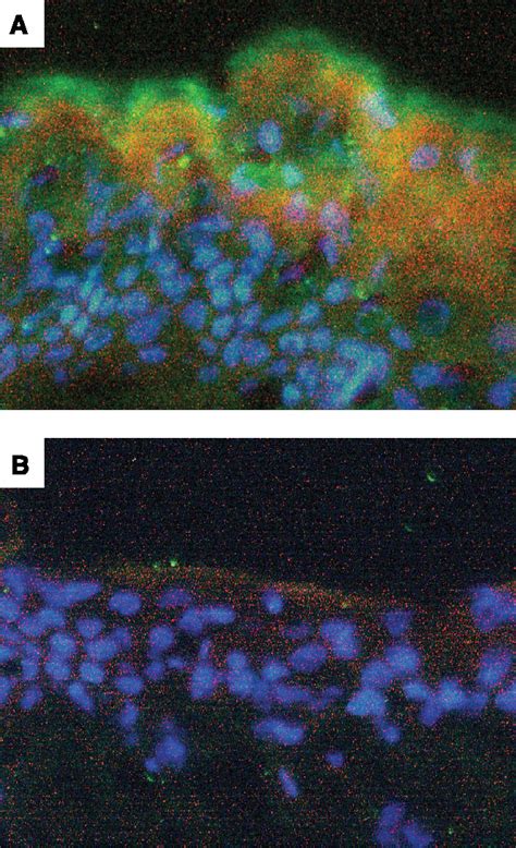 Figure 4 From The FASEB Journal Research Communication Kallikrein