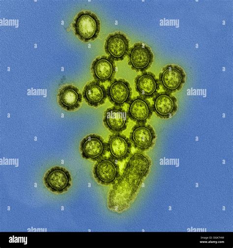 Electron microscope image of H1N1 influenza A Stock Photo - Alamy