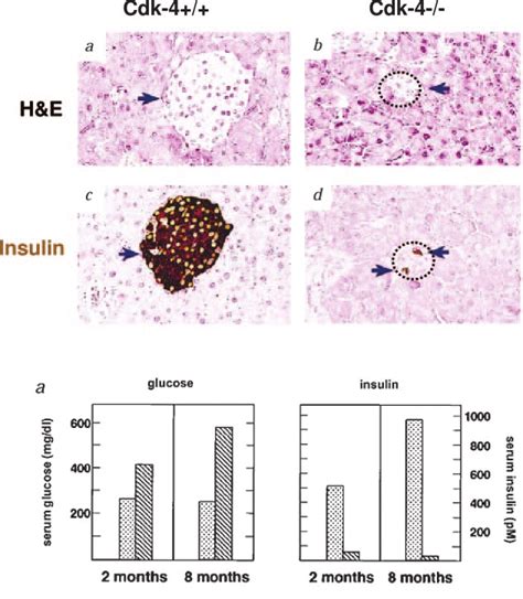 Consequences Of Cdk Loss In The Murine Islet The Four Upper Panels