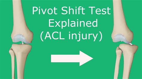 Pivot Shift Test Fully Explained ACL Injury YouTube