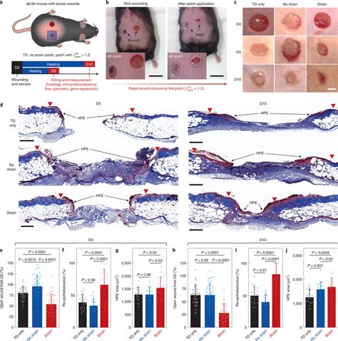 Evaluation Of Diabetic Wound Healing In A Db Db Mouse Model A