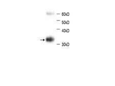 HBB / Hemoglobin Beta - LSBio