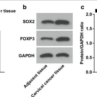 MiR 185 3p Expression Decreases While SOX2 CCAT1 And FOXP3