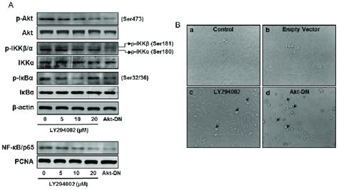 Effect Of Akt Inhibition On The Expression Of P Akt Ser Akt