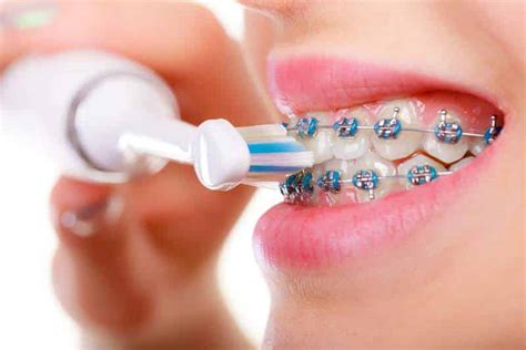 Best Toothbrush For Braces 2021 - Dentist Recommended