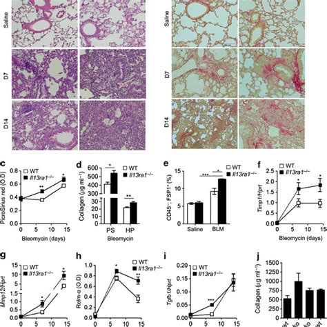 Altered expression of human and mouse IL-13 receptor chains in IPF. The ...