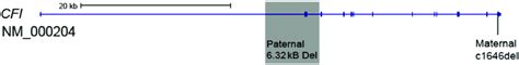 Integrative Genomics Viewer IGV Depiction Of Variants On CFI Gene