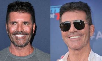 Simon Cowell's teeth before and after: What has BGT star done to his ...