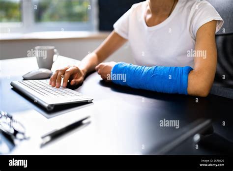 Woman Broken Arm Hi Res Stock Photography And Images Alamy