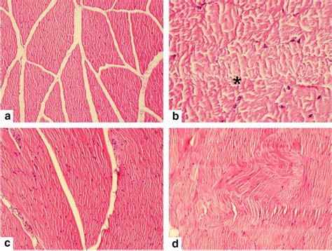 a Photomicrograph of muscles of sheep from site 1. Normal (H& 10). b ...