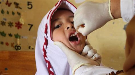 Klb Polio 39 Juta Balita Di Jawa Barat Akan Diimunisasi Setelah