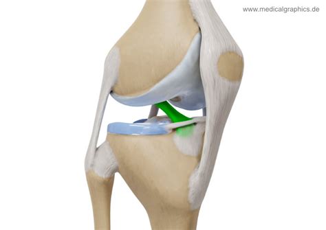 Anterior cruciate ligament - MedicalGraphics