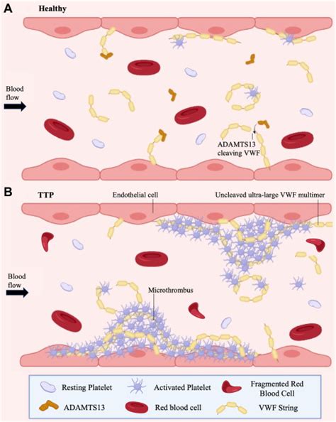 Targeted ADAMTS-13 replacement therapy for thrombotic thrombocytopenic ... 