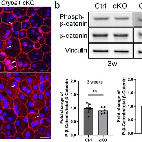 Disrupted Apical Basal Polarity In Rpe Cells Lacking Cryba1 A Western Download Scientific