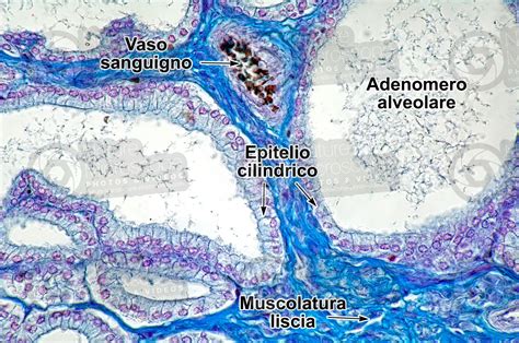 Uomo Anziano Prostata Sezione Trasversale 250X Uomo Mammiferi