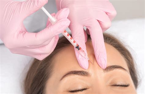 Everything You Should Know About Anti Wrinkle Injections