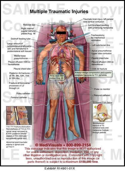 Traumatic Injuries