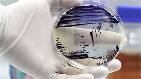 FEMS Microbiology Reviews | Oxford Academic 