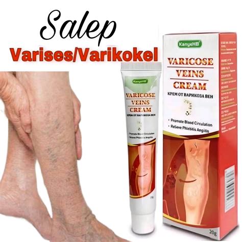 Varicose Veins Cream Gr Salep Obat Varises Penghilang Parises