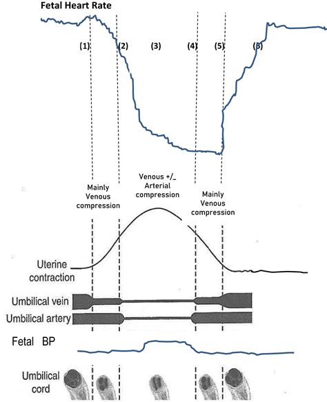 Scientific Pathophysiology Of Intrapartum Fetal Hypoxemia And Cardiotocography Pattern