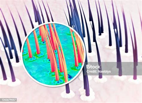 피부 모발 모발 건강 트리코로지 지방 모발비듬 손실의 표면 모발 구조 모낭에 대한 스톡 사진 및 기타 이미지 모낭 정밀