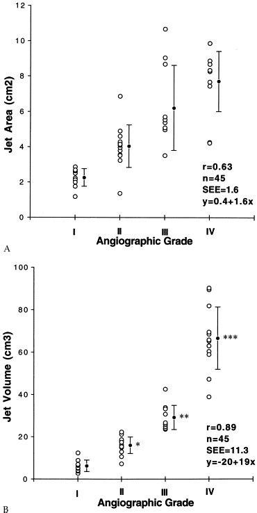 Assessment Of Mitral Regurgitant Jets By Three Dimensional Color