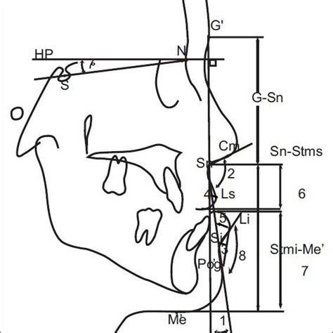 Soft Tissue Measurements 1 Facial Convexity Angle 2 Nasolabial Download Scientific Diagram