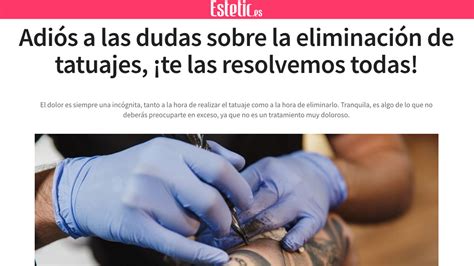 Adi S A Las Dudas Sobre La Eliminaci N De Tatuajes Te Las Resolvemos