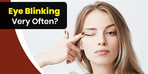 Excessive Eye Blinking Treatment | Onlymyhealth