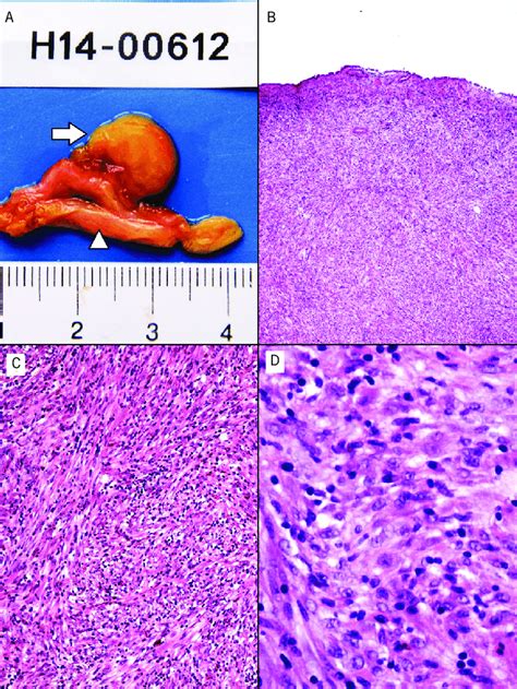 Gross And Microscopic Examination Pathological Findings Of