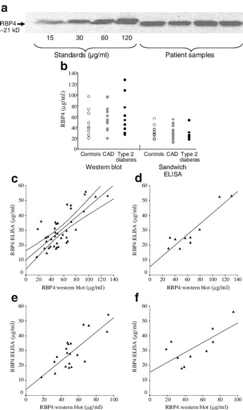 A Quantitative Western Blotting Of Serum Rbp4 Serum Rbp4 Levels Were