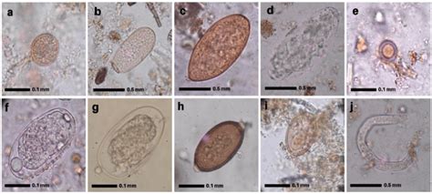 Photomicrographs Of Gastrointestinal Parasites In Faecal Samples Of Six Download Scientific