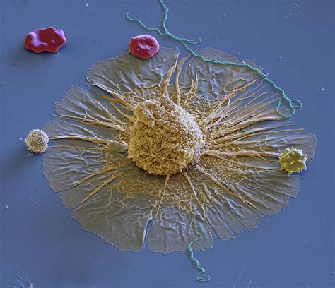 Macrophage Erythrocyte And Lymphocyte Photograph By Meckes Ottawa Pixels