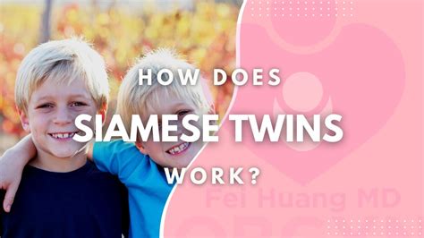 How Does Siamese Twins Work Youtube