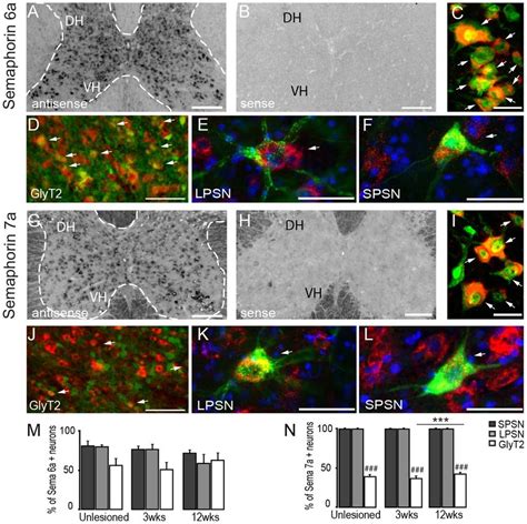 In Situ Hybridization Pattern Of Semaphorin A And Semaphorin A In The