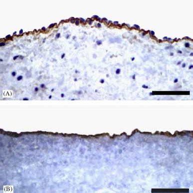 Histology Of Native And Decellularized Pv H E Staining A Native