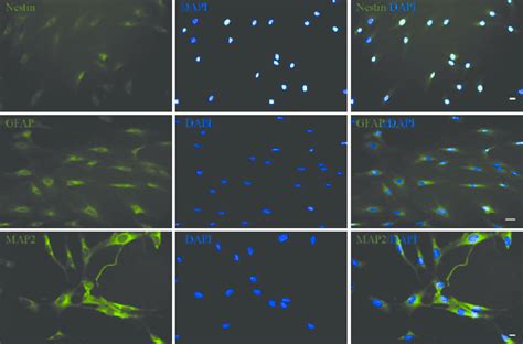 Immunocytochemical Staining For Neural Markers Nestin Glial Fibrillary