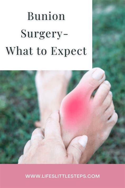 Tips For Preparing For Foot Surgery Artofit