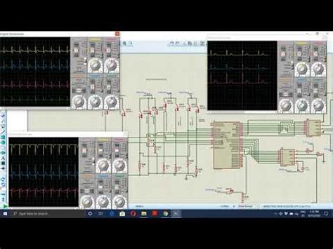 Simulador señales ECG YouTube