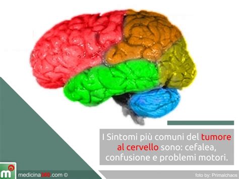 Tumore Al Cervello Sintomi Cure Cause Diagnosi E Sopravvivenza