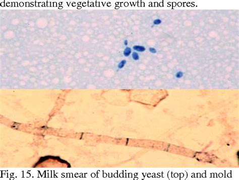 Figure 15 From The Microscopic Examination Of Milk Characterization Of