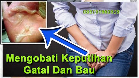 Cara Mengobati Keputihan Yg Gatal Dan Bau Youtube