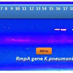 Virulence Genes Amplification Assay For K Pneumoniae Image Of Agarose