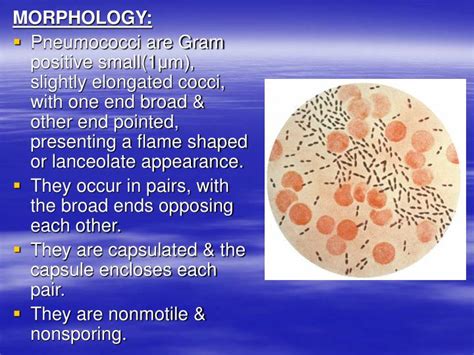 PPT - Streptococcus pneumoniae PowerPoint Presentation - ID:1160282