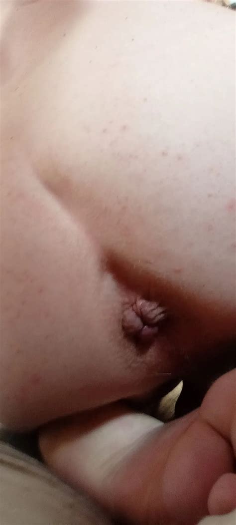 Anal Plug Virbrator Drin Gehabt 17 Pics XHamster